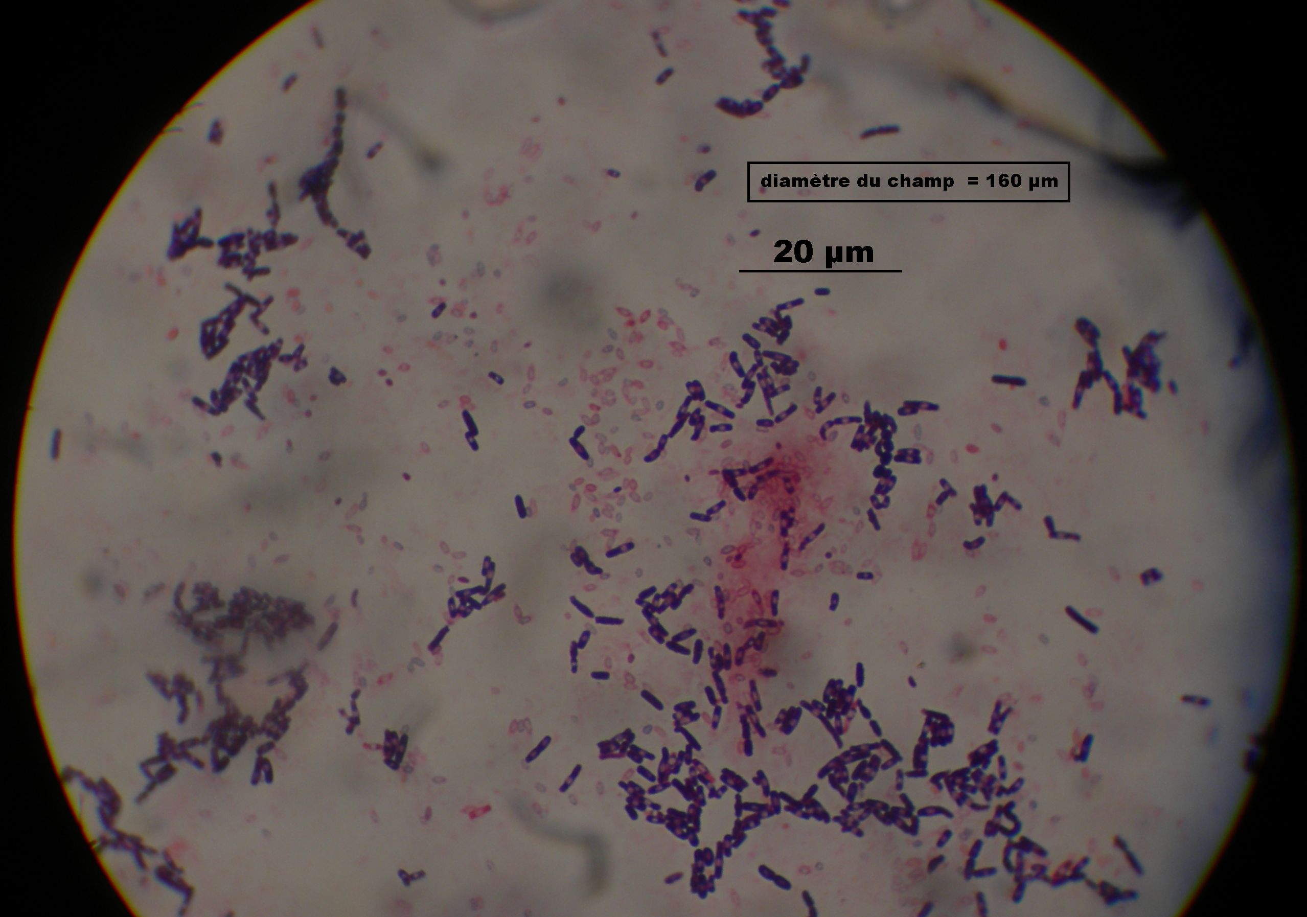 Bacille Gram + de l'environnement montrant des spores